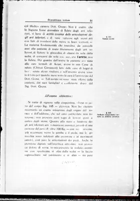 Fotogramma E 11