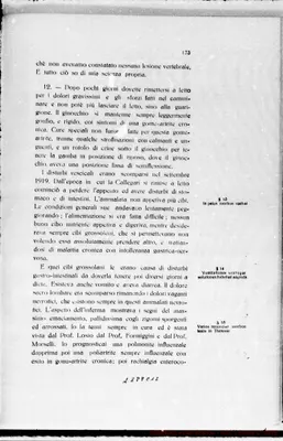 Fotogramma C 12