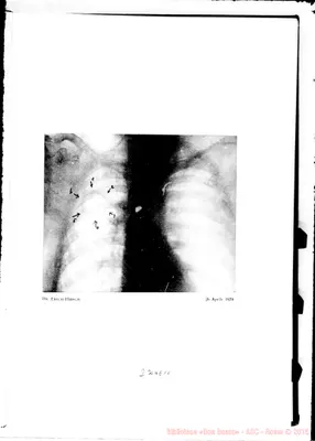 Fotogramma E 11