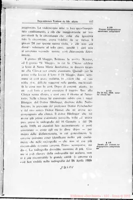 Fotogramma B 1